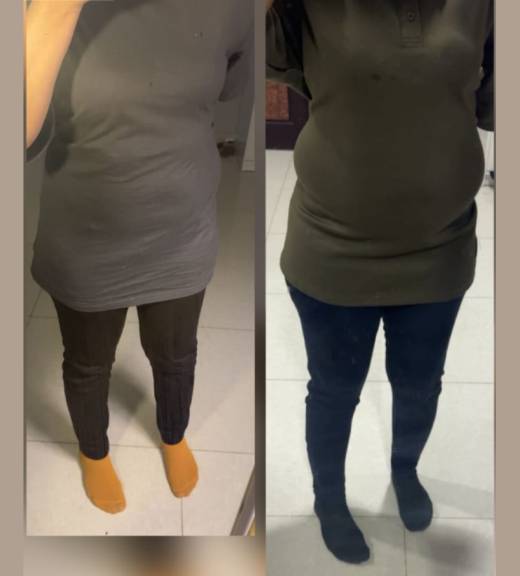 Zahraa success story - Renal-Balance Care Program